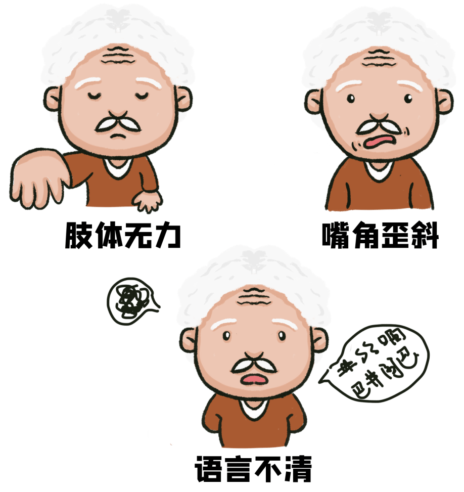 01早期的症状可能表现为面瘫,偏身的麻木,面目的感觉障碍;02会突然