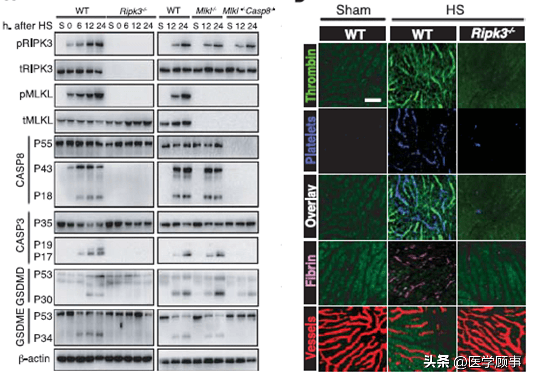 病中的作用,发现了高体温通过ripk3途径而非hmgb1-caspase-11途径诱发