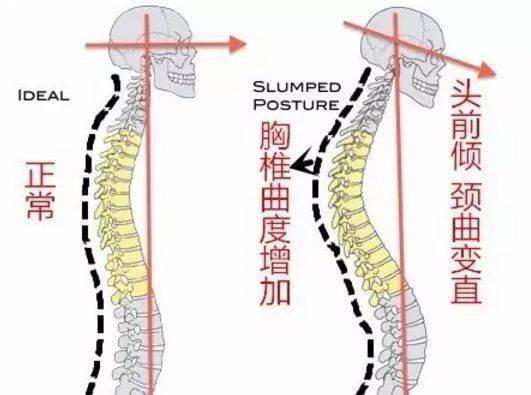 很多女孩都躲不过斜方肌四个动作可消除