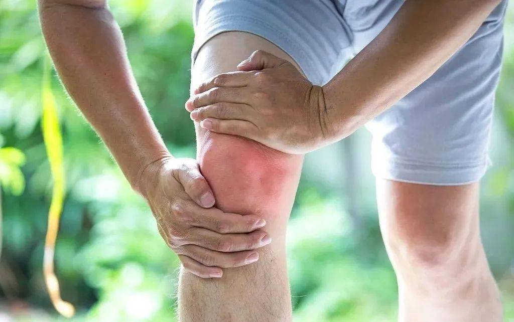 您是否有膝关节疼痛,肿胀,僵硬,畸形及活动受限等症状,如果您及您的