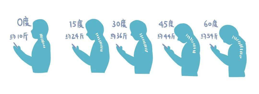 注意低头玩手机颈椎顶40斤颈椎究竟怎么保养4个动作简单易学