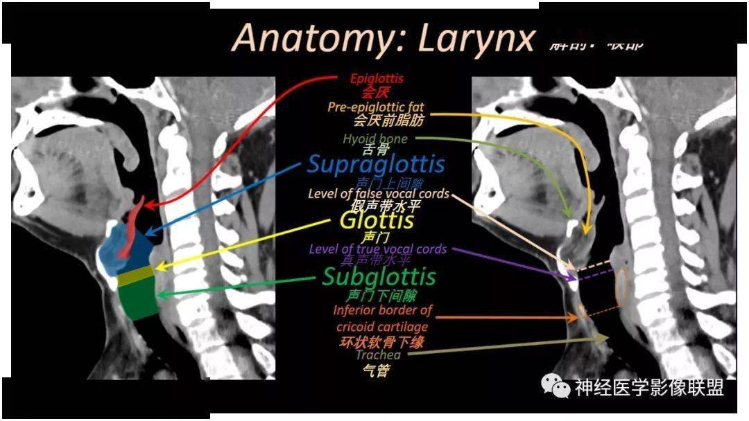 喉部ct解剖