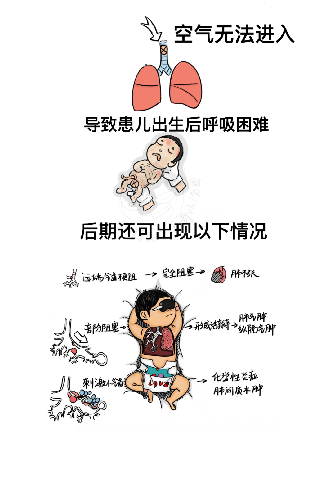 漫画还原值班遇新生儿胎粪吸入_汤圆_公众_夜班