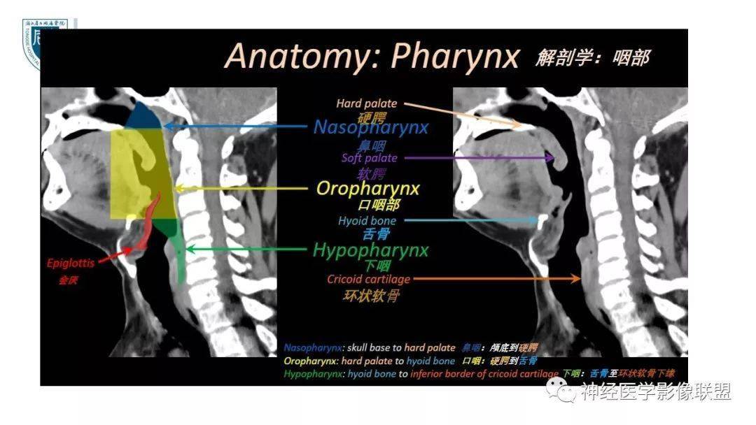 口咽部ct解剖图图片
