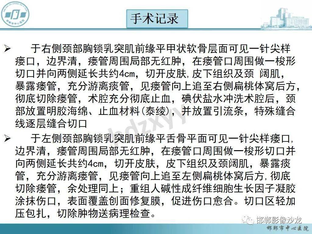 先看病例再分析颈部鳃裂瘘管
