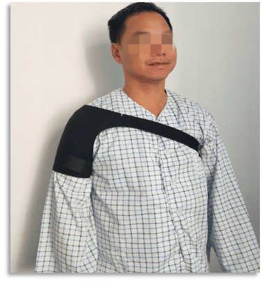 手功能基地系列微文69肩手综合征的预防基于康复护理视角