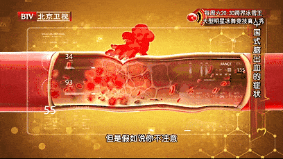 408_229gif 动态图 动图