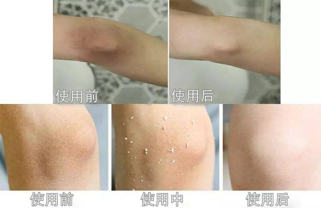 什么药能让鸡皮肤变白变厚(什么药能让鸡皮肤变白变厚呢)