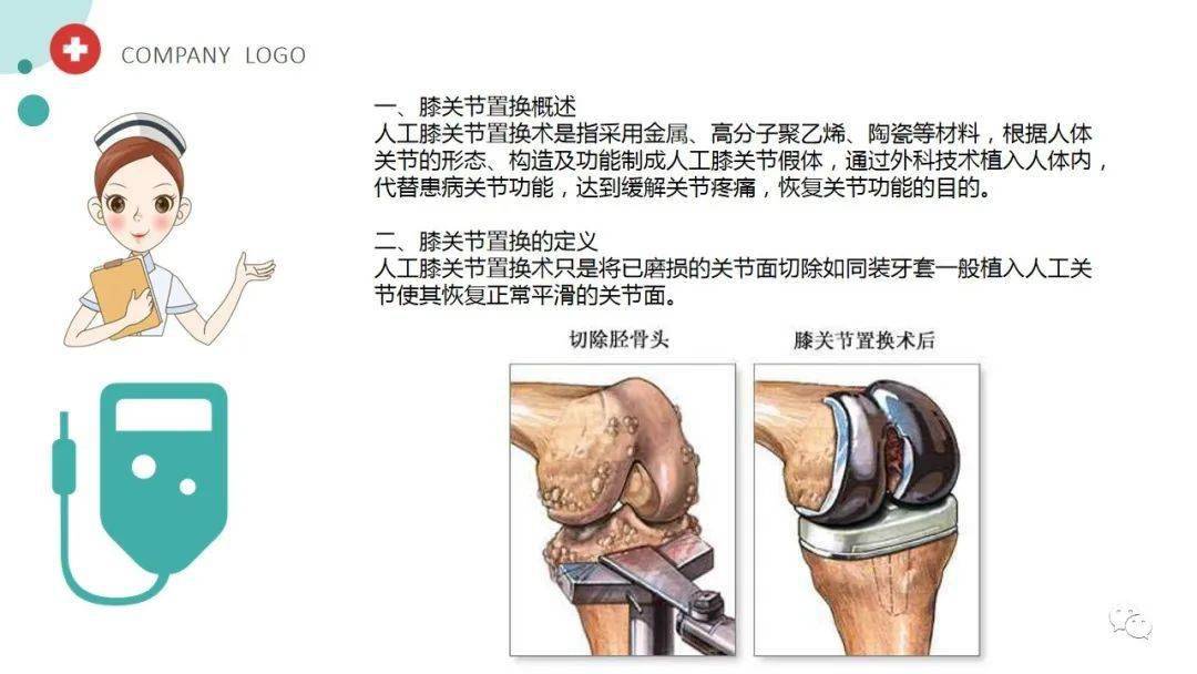 膝关节置换 示意图图片