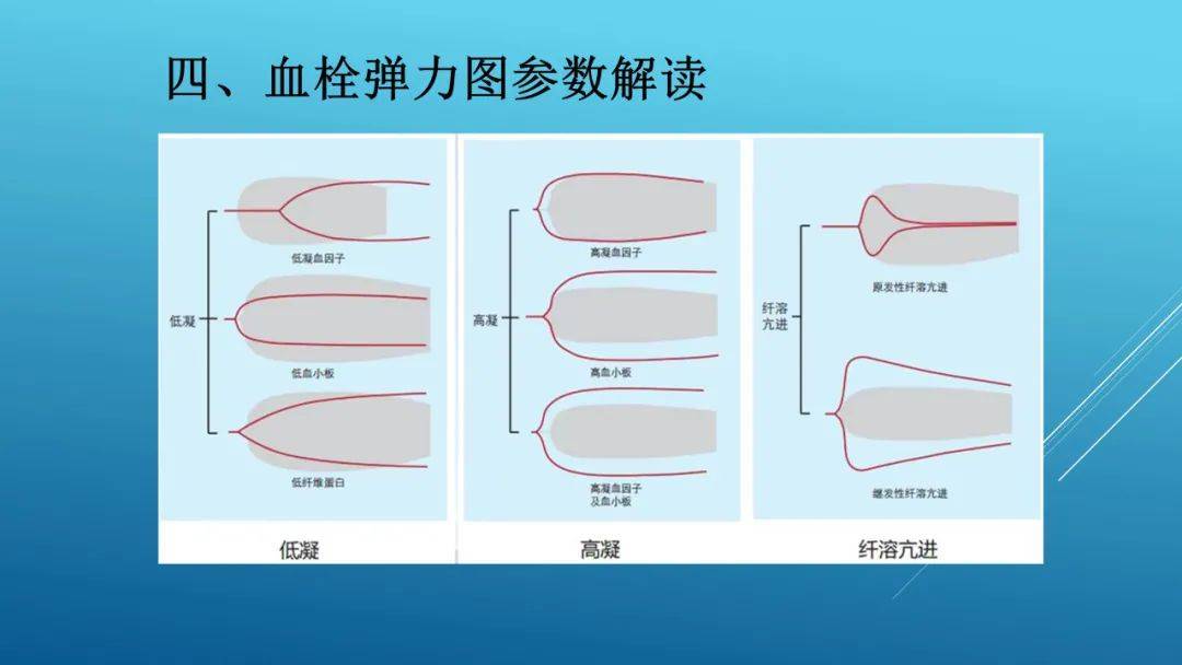 6月阅读:血栓弹力图的介绍与应用_异议_立场_网站
