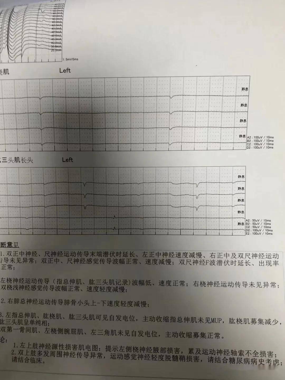 肌电图结果图片