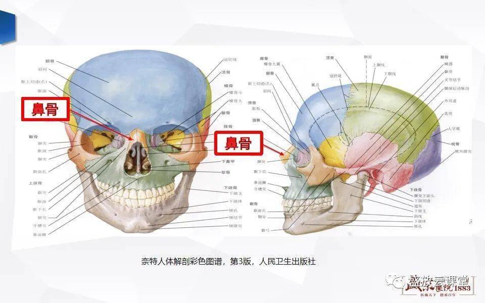 鼻骨正常ct解剖变异与骨折