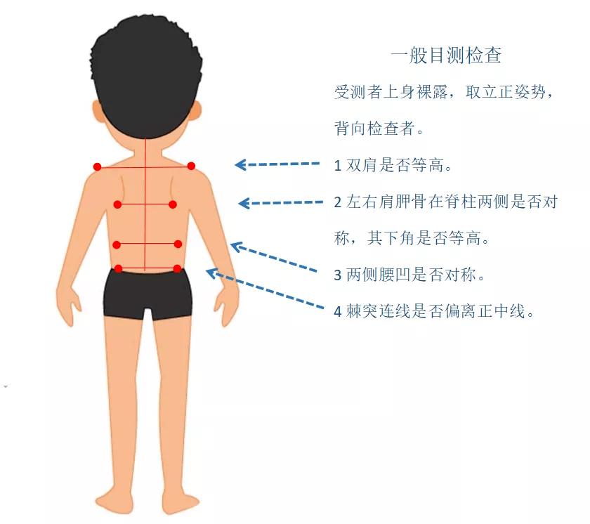 繼肥胖症,近視之後,威脅中國兒童健康的第三大