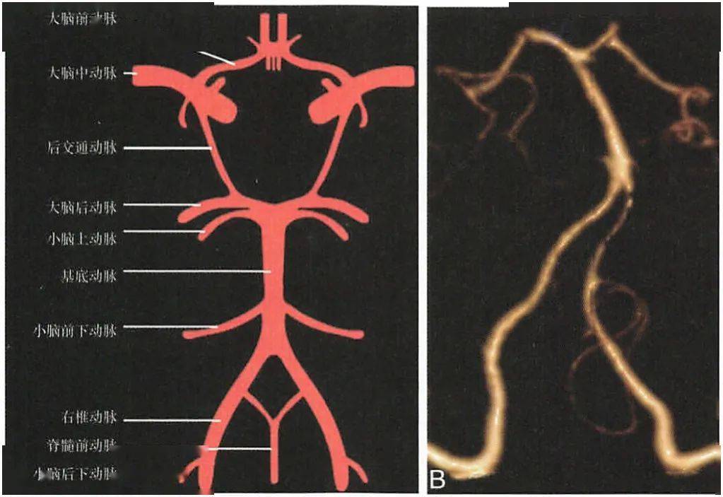 颅内动脉 颅内血管解剖和变异