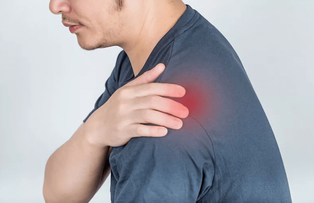 肩周炎现在不光老年人有,很多年轻人也有,表现多为肩膀无痛点的疼痛