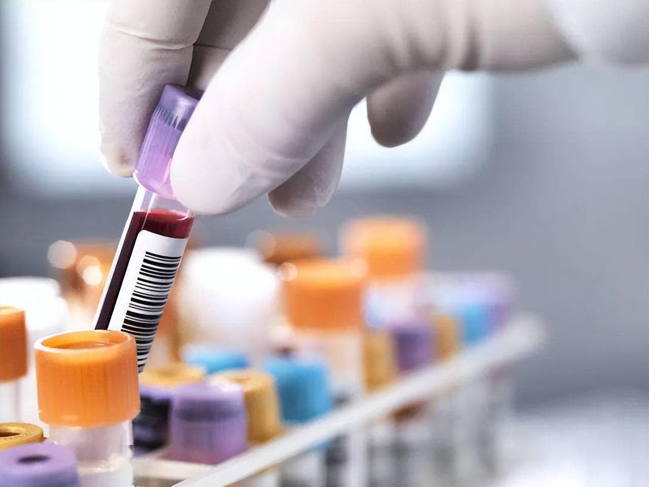 抽血能查出什么病?为啥一抽就好几管,化验完的血用来干嘛?_检查_血液_