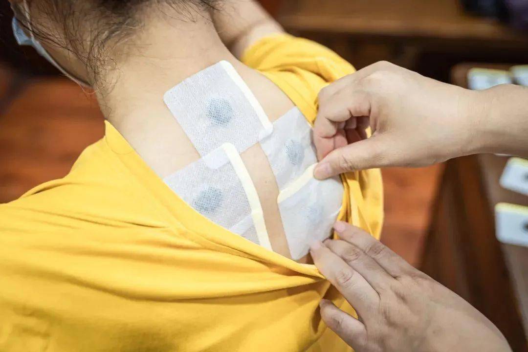 幸孕传递!湿气重三伏贴贴哪里图片"金榜题名"-第1张图片-凯飞博客