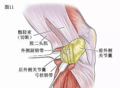 膝關節解剖學:膝關節的四面觀_培訓_韌帶_臨床