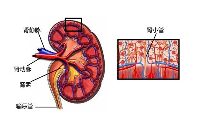 泌尿腫瘤分子診斷在遺傳性腎癌中的應用