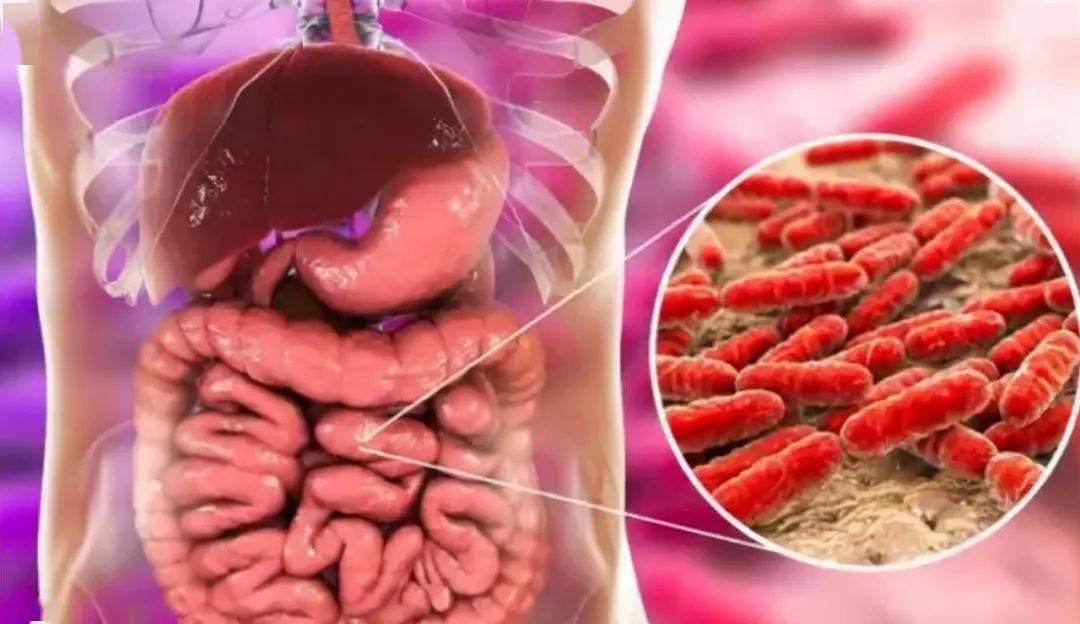 61岁阿姨黑便10余天发现恶性肿瘤,排便竟是人体健康晴雨表_肠道_大便