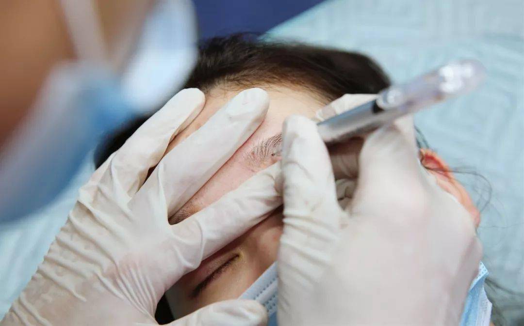 麻药灼伤处理方法 :1.