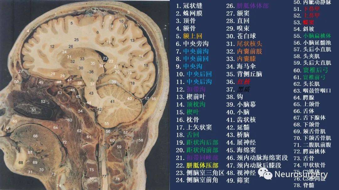颅脑断层解剖图谱
