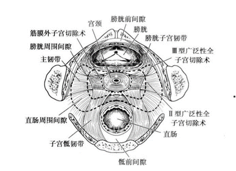 宫颈组织结构分层图片