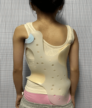 成为"浙江省脊柱侧弯中西医诊疗专科联盟"成员单位_温州市_治疗_推拿