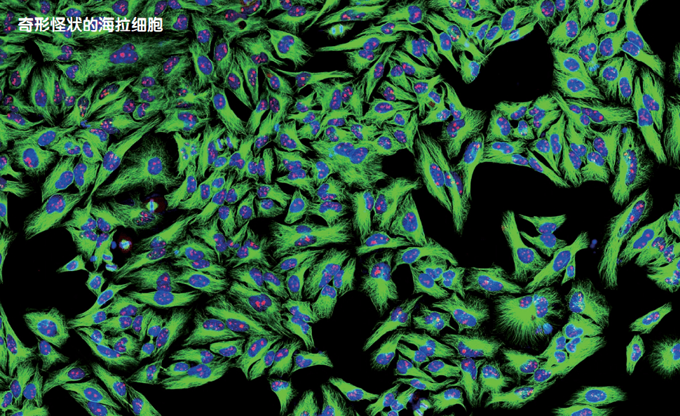 如果生物由癌细胞组成 海拉 拉克斯 组织
