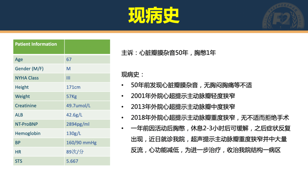 患者资料基本情况,既往病史,合并症,sts评分和nt-probnp:入院超声心动