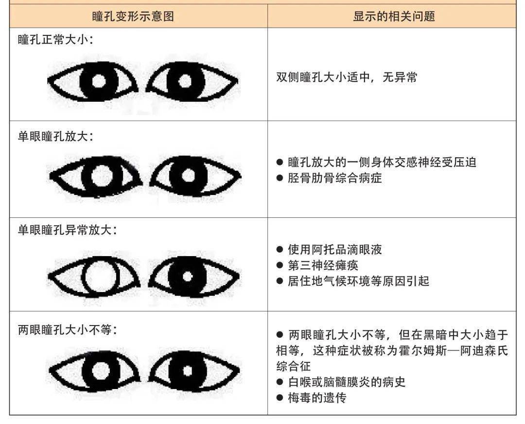 瞳孔和瞳仁的区别图图片