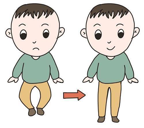 小小孩罗圈腿家长们焦虑得太早了