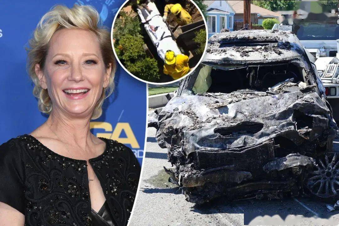 知名女星突发车祸!严重烧伤情况危急_安妮·海切_父亲_视频