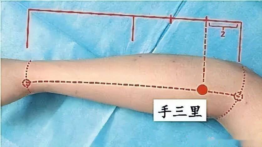 接下來再說手三里.這個穴位被廣為傳頌為治療手