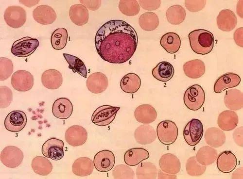 润浓农业对虾养殖中不容忽视的肝肠胞虫_塘底_病原_虾塘