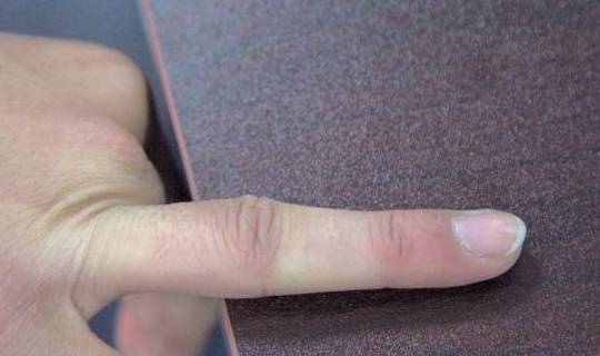 若发现手部手指顶端,突然变粗,整个手指看起来有些像棒槌的形状,要