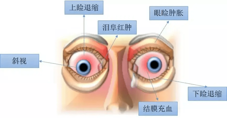 这儿变得又大又突,医生:这项指标尽快检查!