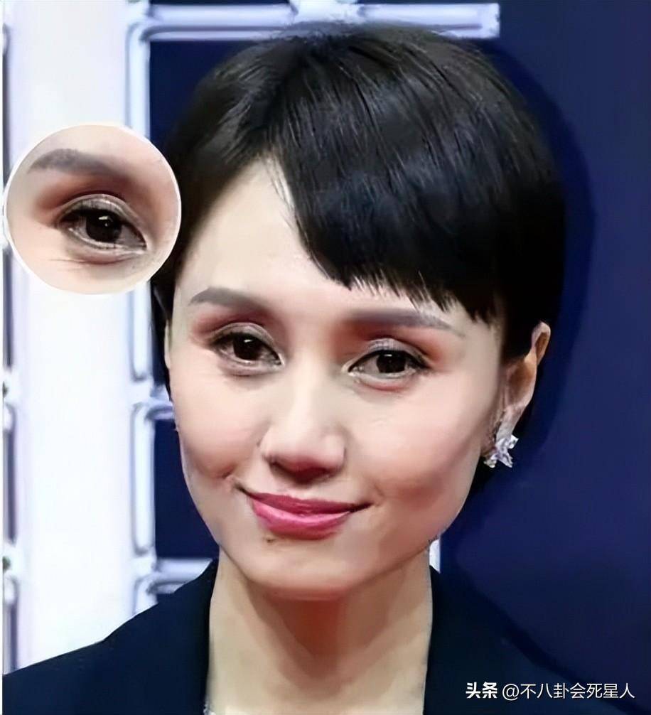 却"败"在眼皮的明星,杨幂疲态尽显,袁泉不耐看_眼窝_新剧_眼睛