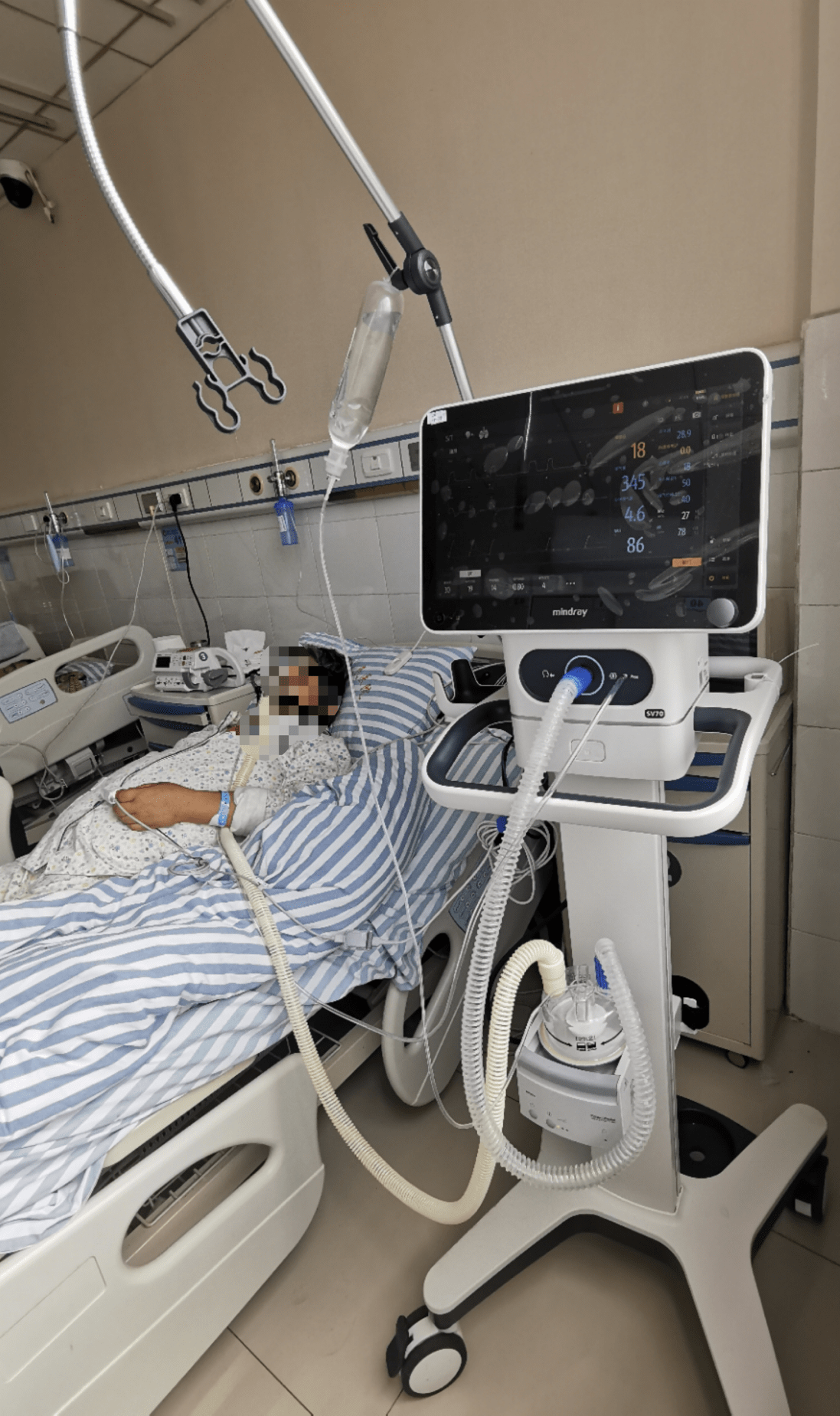 迈瑞入局无创呼吸机市场 助力推进分级诊疗