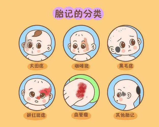 胎记会有并发症吗?_患者_颜色_癌变