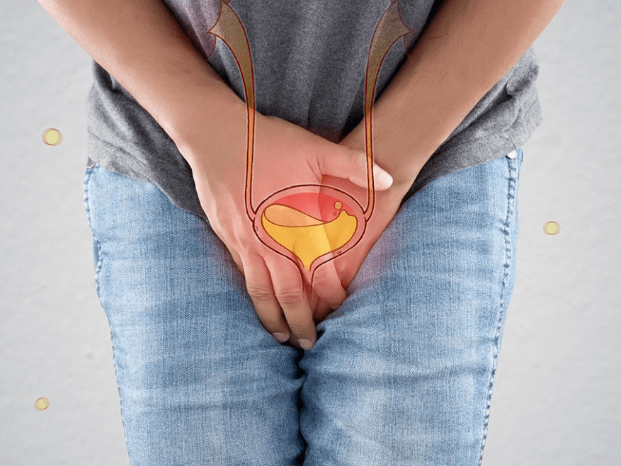 女性尿道感染 自愈图片