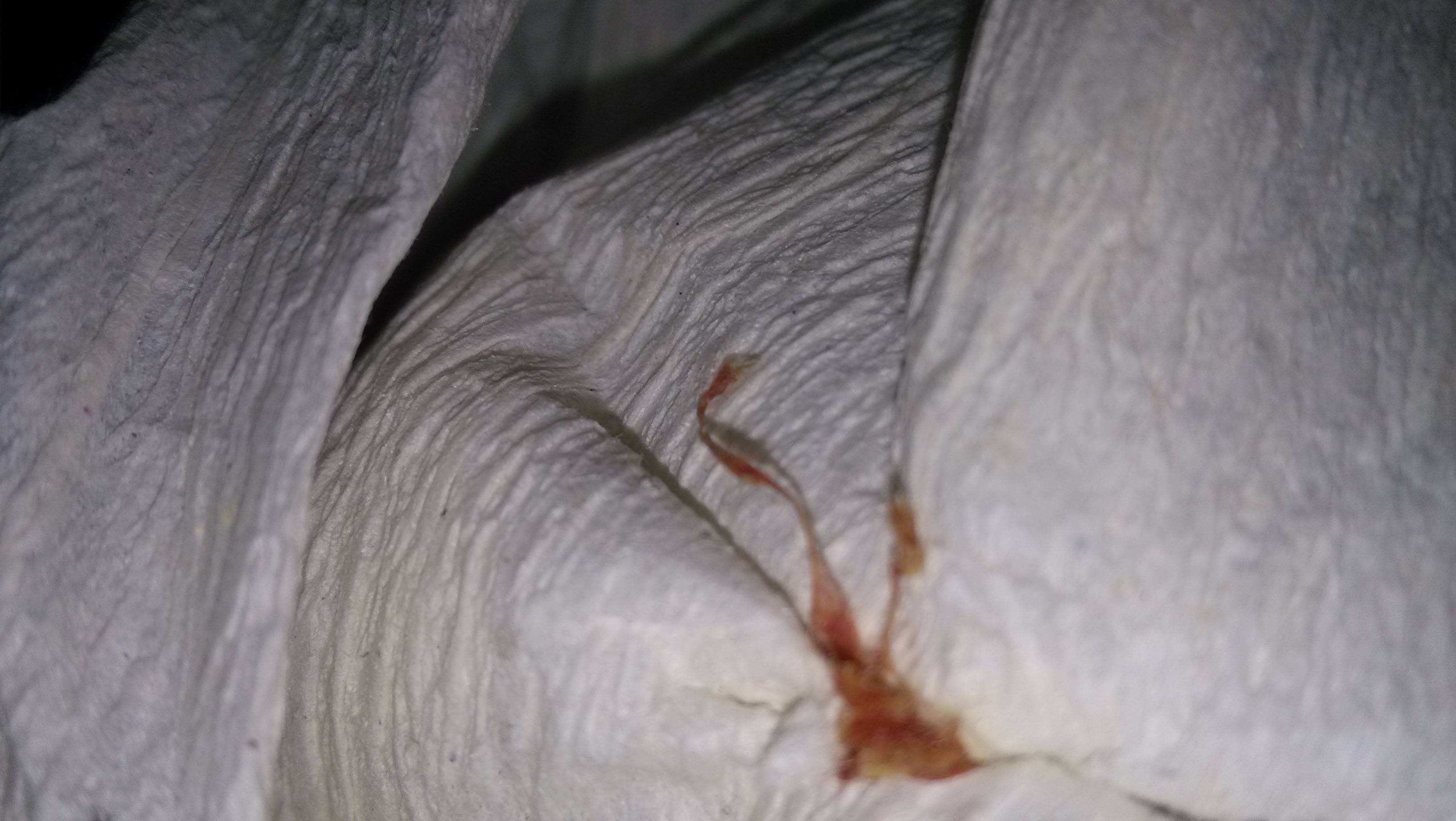 从腐烂到消失,每一步都不可逆_尸体_血液_小时