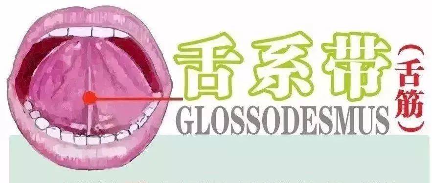 “剪舌筋”——该不该让孩子挨这一刀?_发音_舌尖_影响