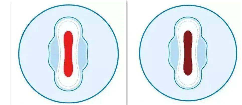 颜色不对要警惕!_月经_子宫_病变