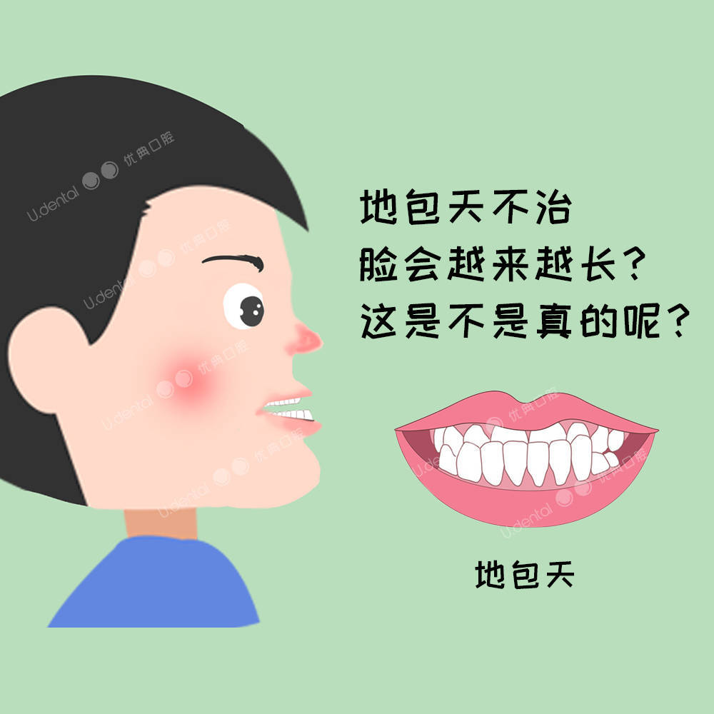 地包天不治脸会越来越长吗?_影响_面部_前牙