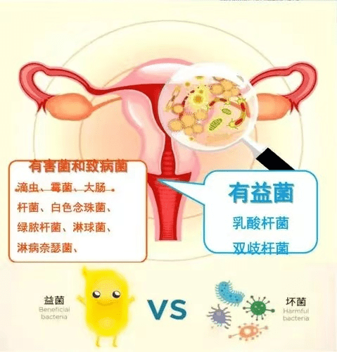 陰道內的乳酸桿菌明顯減少的話,陰道內產的乳酸和過氧化氫就會減少,致