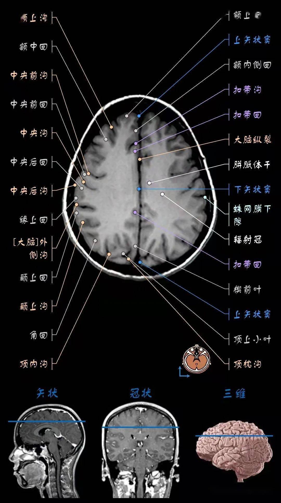 核磁头颅解剖图图片