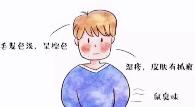 苯丙酮尿症(pku)—"不食人间烟火的天使"【罕见病并不罕见】_患儿_位