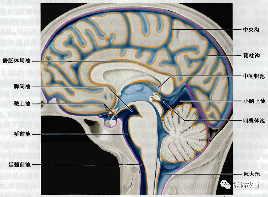 (上)脑室系统3d示意图,从矢状位上,显示了各脑室的正常结构及交通路径