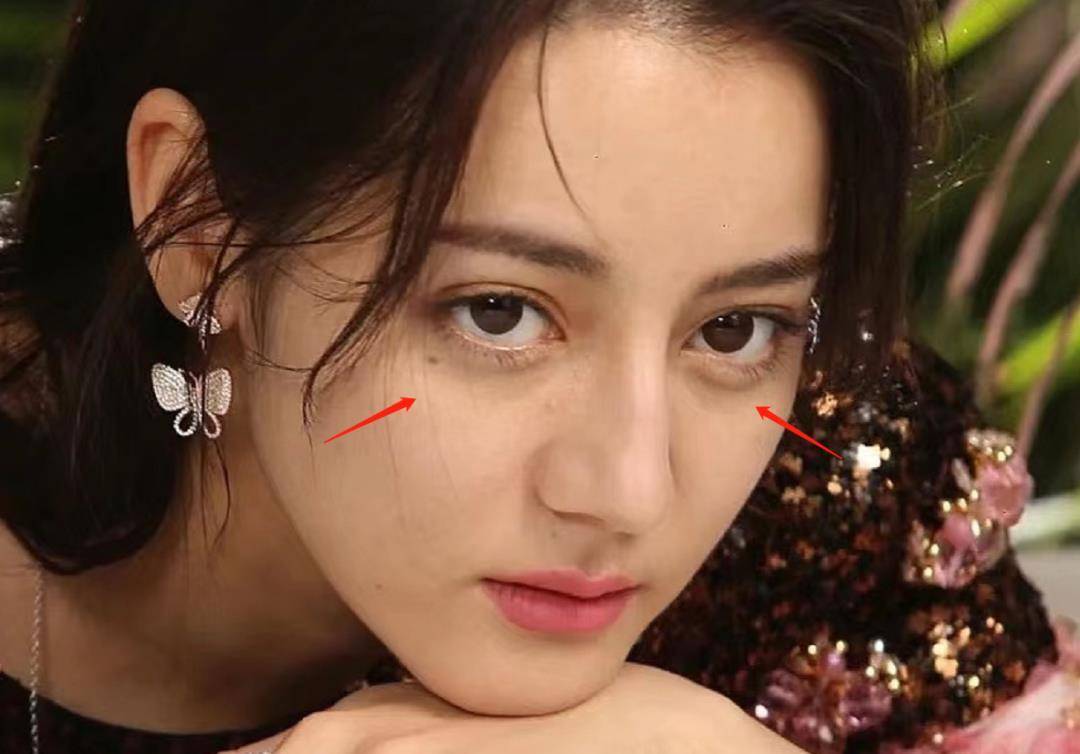 方形脸痘痘肌,内娱颜值天花板滤镜粉碎_问题_照片_脸型